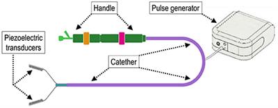 Lithotripsy of Calcified Aortic Valve Leaflets by a Novel Ultrasound Transcatheter-Based Device
